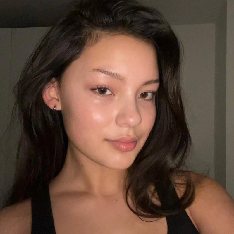 Before — 